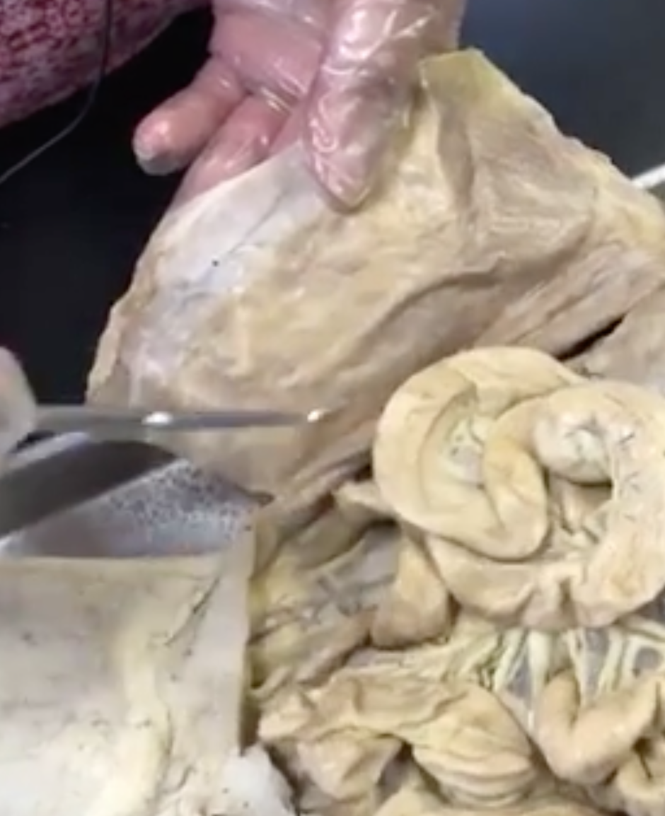 <p>what is the “flap” structure she is holding</p>