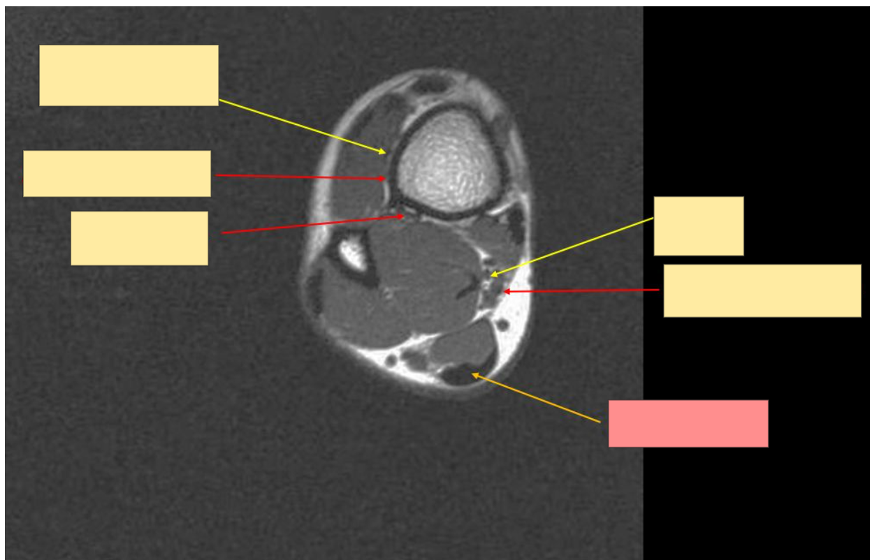 <p>Identify this structure</p>
