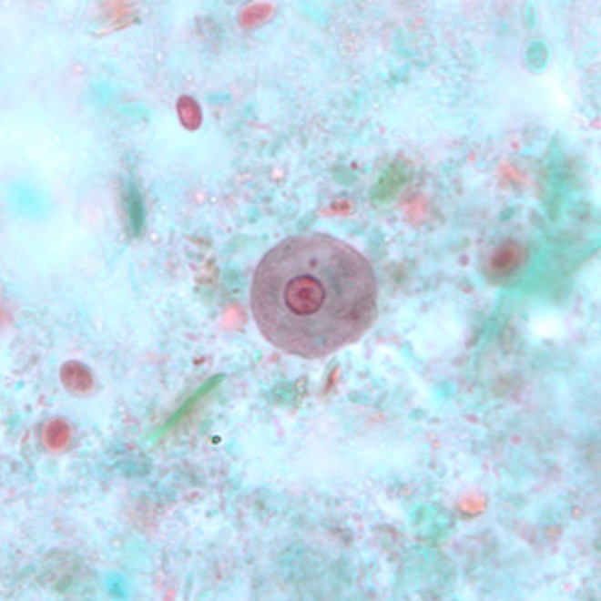 term image