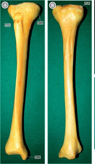 <p>name and side this bone </p>