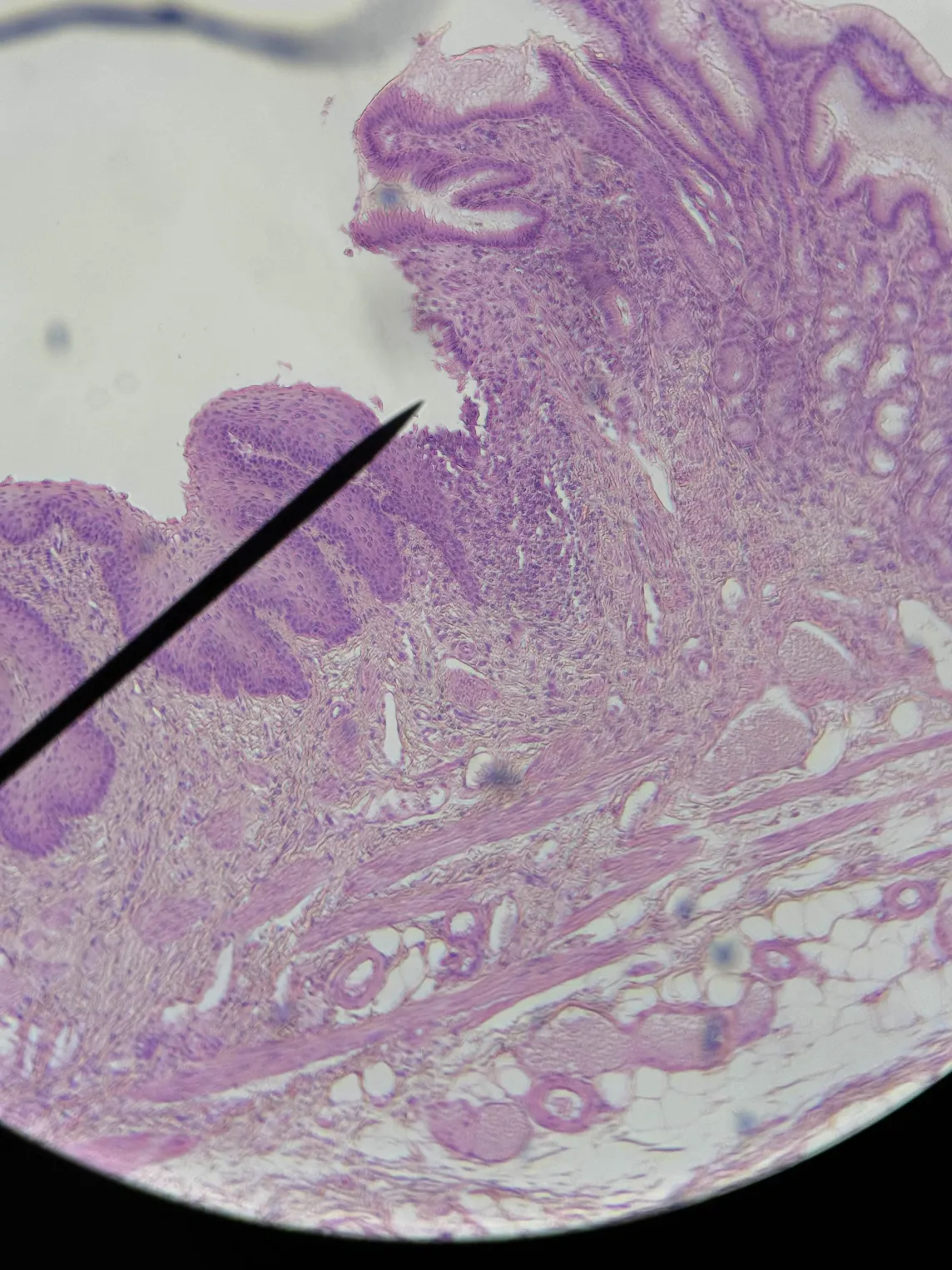 <p>Identify structure &amp; which side</p>