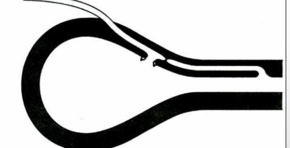 <p>What procedure for ectopic ureters refers to ligating and reattaching the ureter to a new location on the bladder, closer to the normal location/trigone? The remaining distal part and abnormal attachment are left.</p>