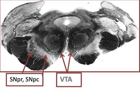 <p></p><p>Pars Reticulata (SNr):</p><ul><li><p>GABAergic = inhibitory</p></li><li><p>output section of BG → thalamus and BS</p></li></ul><ul><li><p><strong>role in eye movement and cognition</strong></p></li></ul><p></p><p>Para Compacta (SNc):</p><ul><li><p>Dopaminergic (DA) = excitatory and inhibitory</p><ul><li><p><strong>makes dopamine, makes melanin (how it gets its color)</strong></p></li></ul></li><li><p>densely packed, pigmented cells</p></li><li><p>projections to striatum</p></li><li><p>facilitates movement, reward</p></li><li><p>VTA = ventral tegmental area, produces dopamine</p></li></ul><p></p>
