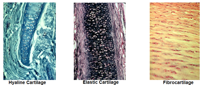 <ul><li><p><strong>Hyaline</strong>: most common arrangement – nasal septum, joint surface, ribs</p></li><li><p><strong>Elastic</strong>: like hyaline but enriched with elastic fibers – ear, larynx</p></li><li><p><strong>Fibrocartilage</strong>: rows of chondrocytes with increased fibrous matrix – intervertebral disks, tendon/ligament attachment</p></li></ul><p></p>