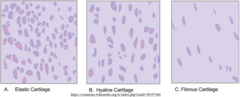<p>hyaline; fibrous; elastic</p>