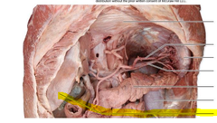 <p>Identify what is indicated by highlighted pointer</p>