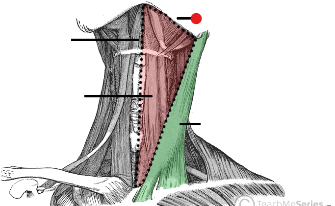 <p>Identify the structure pinned </p>
