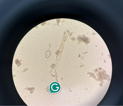 <p>identify</p>