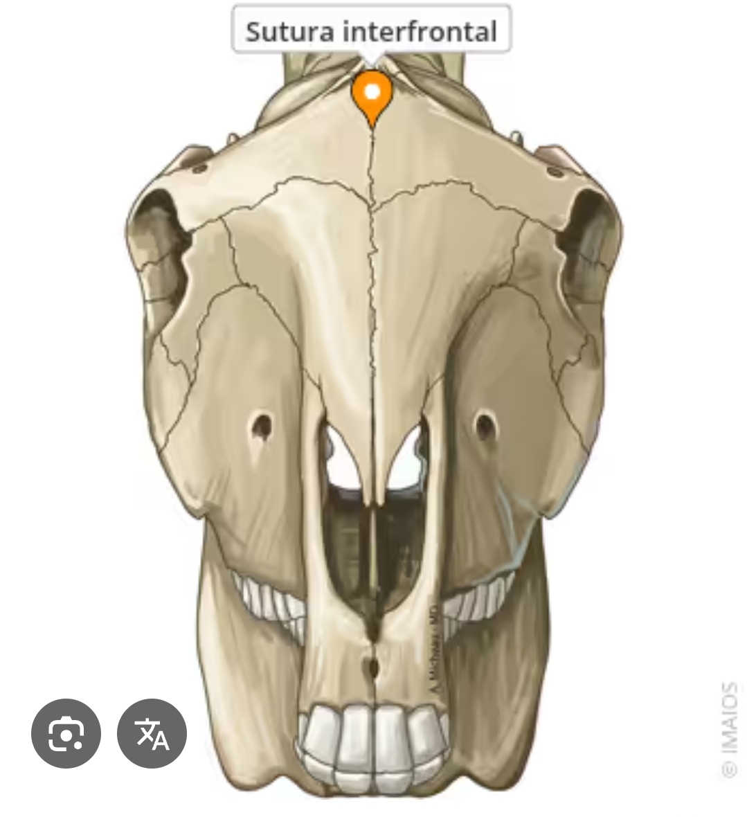 <p>sutura interfrontal</p>