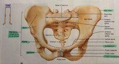<p>prominent portion above the obturator foramen</p>