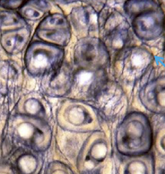 <p>a small, hollow space, cavity, or depression in bone and cartilage tissue (“microscopic caves”) </p>