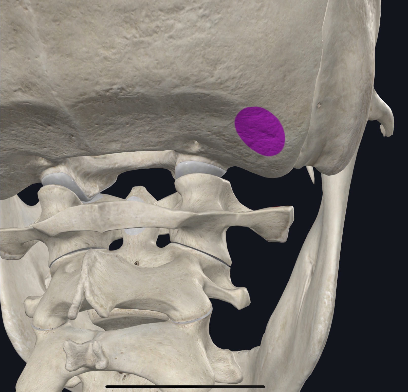 <p>Occipital bone between superior and inferior nuchal lines</p>