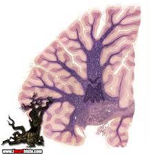 <p>the tree-like pattern of cerebellar white matter located inside the cerebellum at the back of the brain</p>