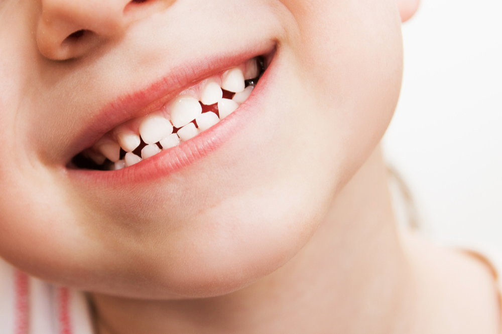 <p>A _______ have two sets of teeth (Ex: Humans → baby teeth)</p>