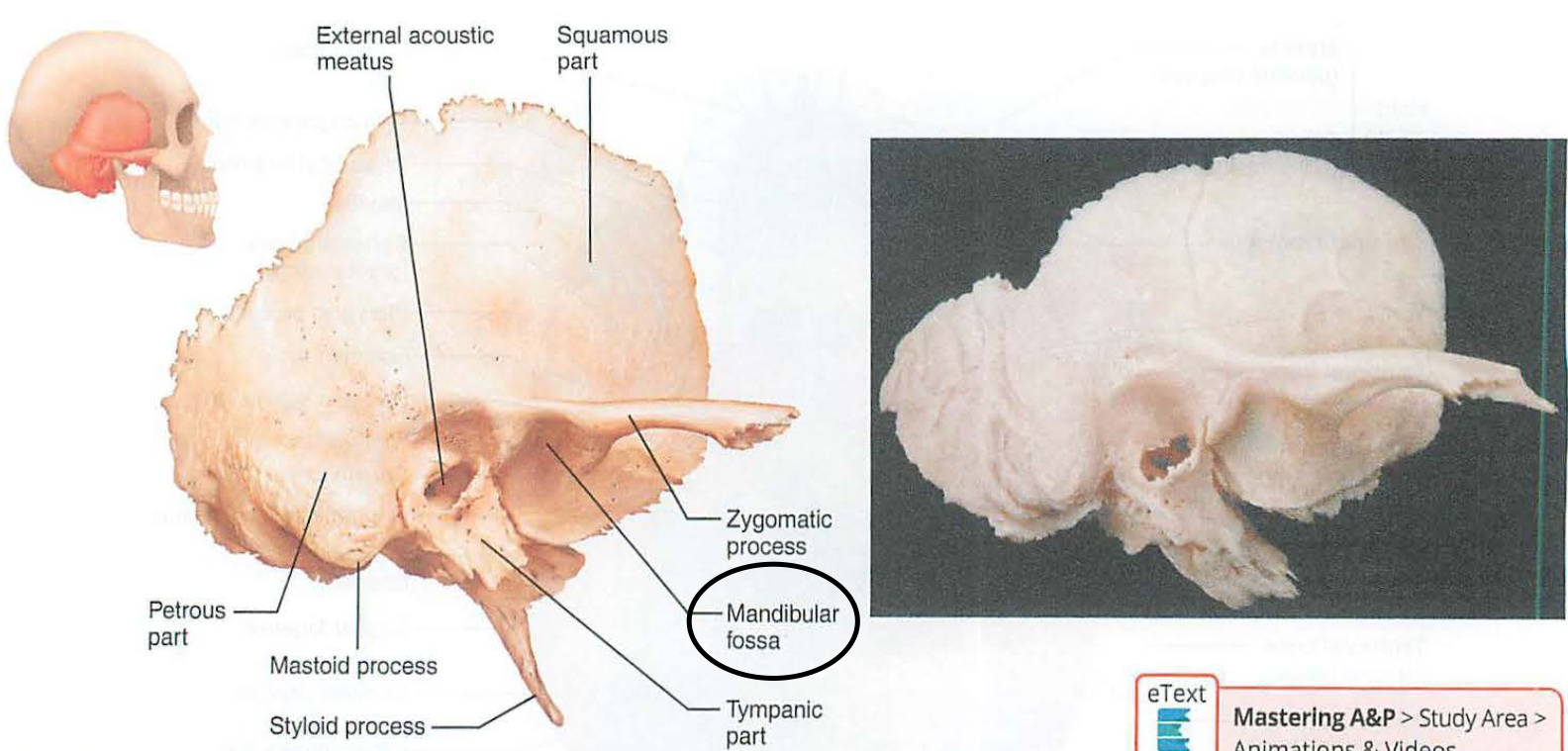 <p>iv. mandibular fossa</p>