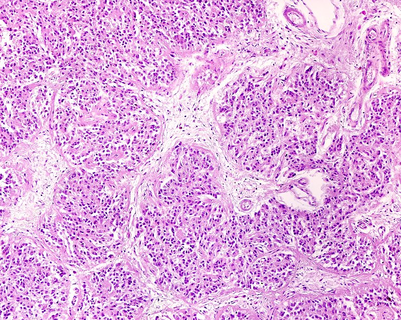 <p>Pinealocytes = dark staining cells w/nucleolus</p><p>Glial cells (support cells)= small dark spots</p><p>pink stuff = C.T</p>