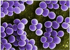 <p>Cell Lysis and Death</p>