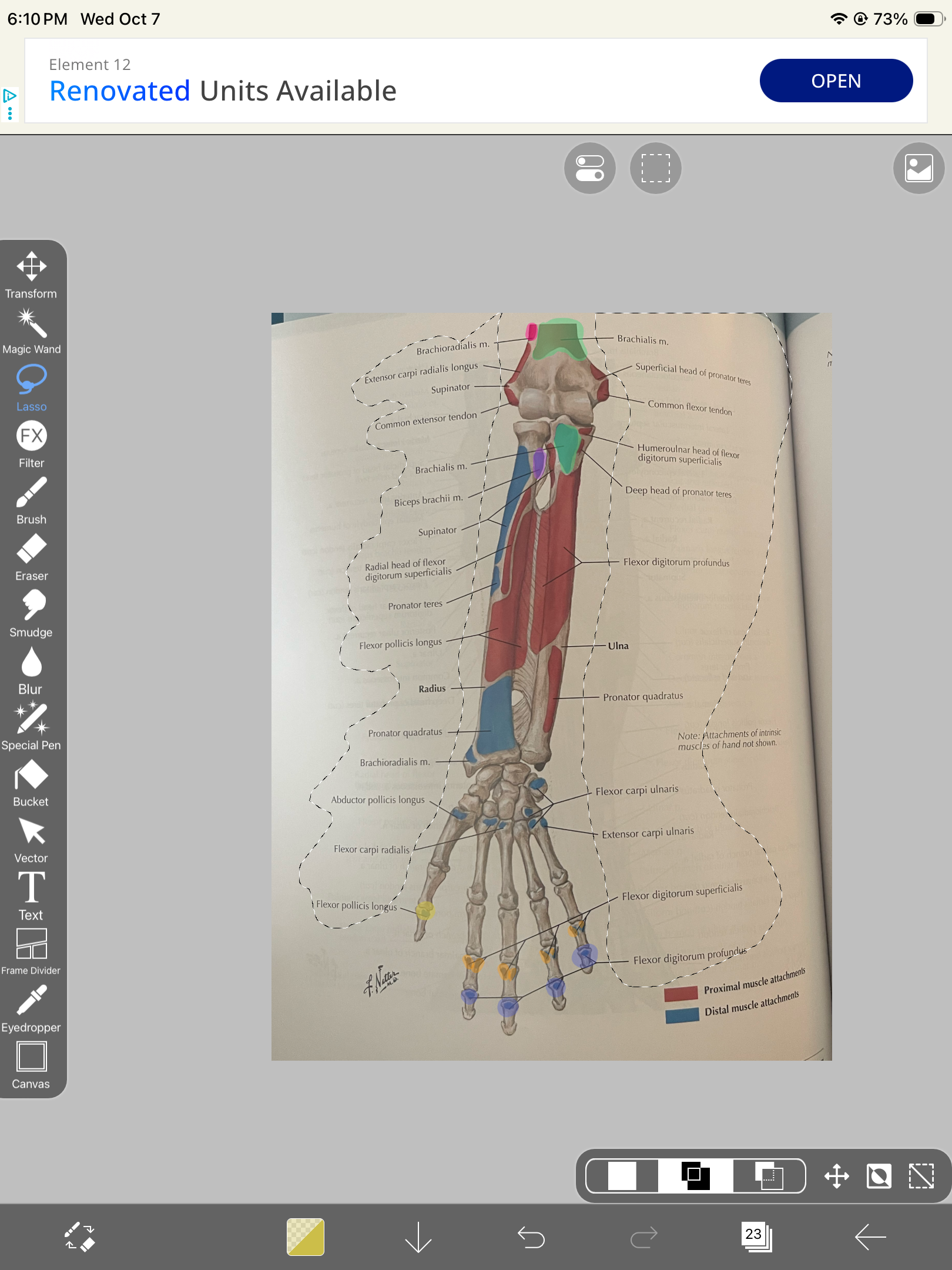 <p>Biceps brachii</p>