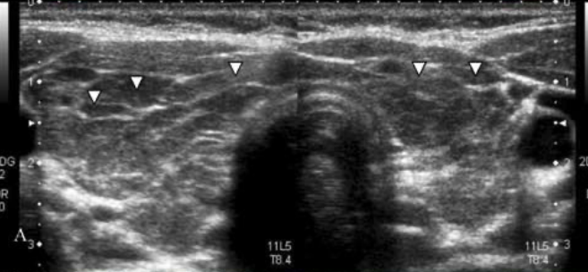 <p>Name the pathology </p>