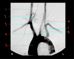 <p>What is labeled 4?</p>