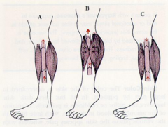 <p>Venous valves and the skeletal muscle pump.</p>
