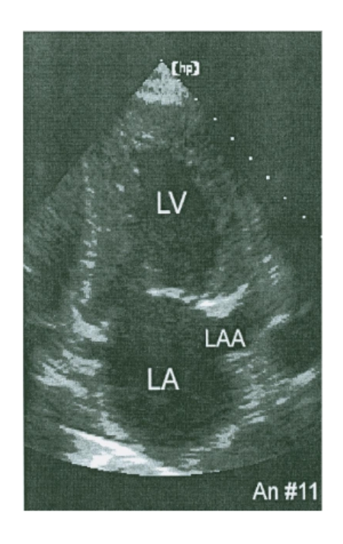 <p>The LAA in Ap2ch </p>