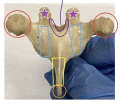 <p>what is outlined in blue</p>