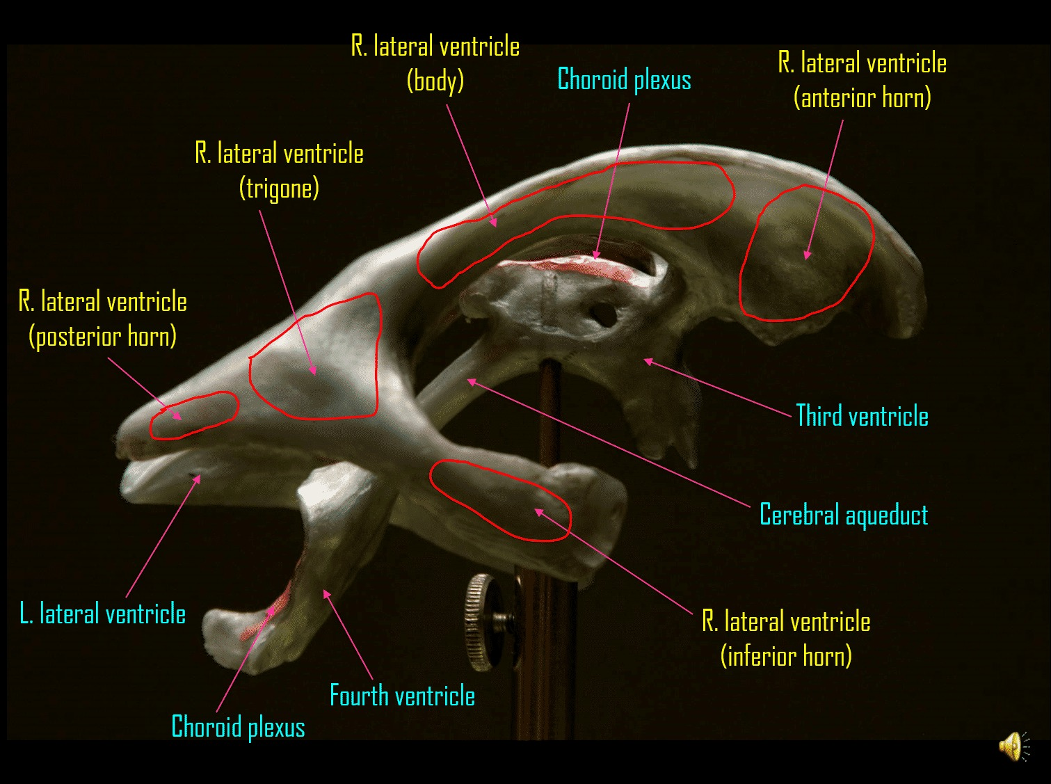 <p>posterior horn, trigone, body, anterior horn, inferior horn </p>