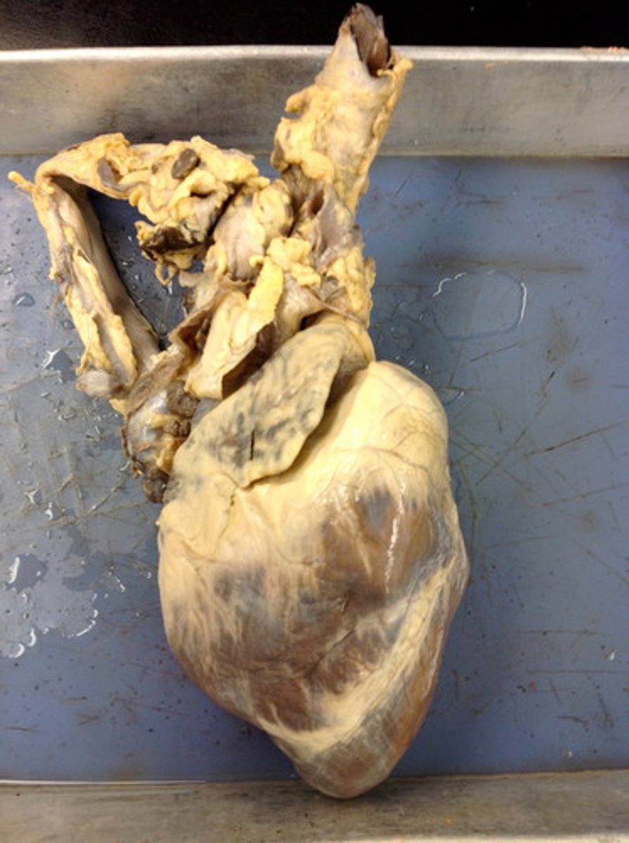 <p>Which View is this heart presenting?</p>