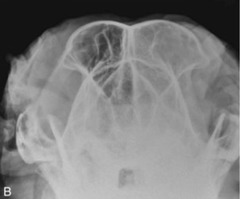 <p>Is this normal or abnormal?</p>