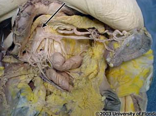 <p>what vein is pictured here?</p>