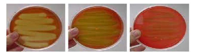 <p>What is blood agar? What type?</p>