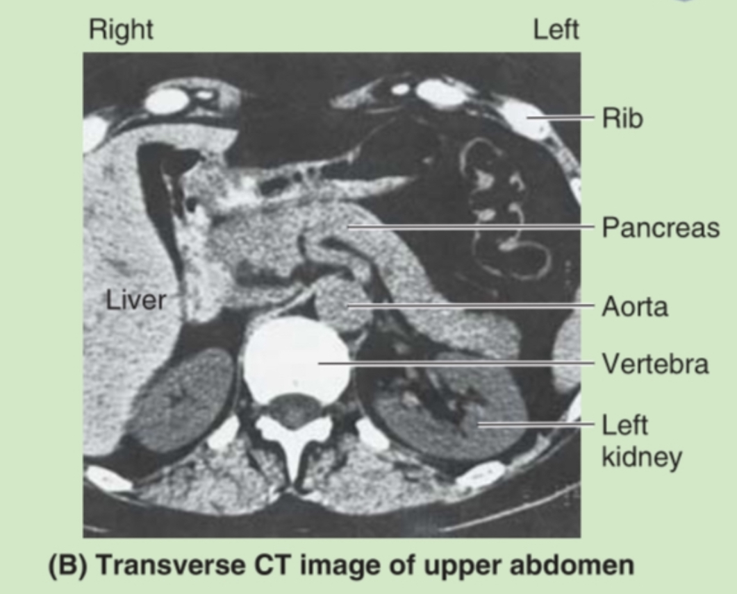 <p>Remember: </p><ul><li><p><span>CT = transverse (cross-sectional) image</span></p></li><li><p><span>Right side of image = patient’s right</span></p></li><li><p><span>Left side of image = patient’s left</span></p></li></ul><p></p>