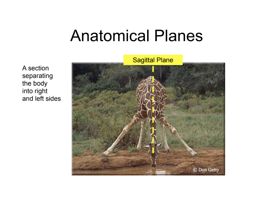 <p>sagittal plane</p>