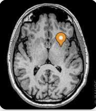 <p>Name the part of the brain, modality, and plane</p>