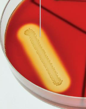 <p>What type of hemolysis is shown in the blood agar? </p>