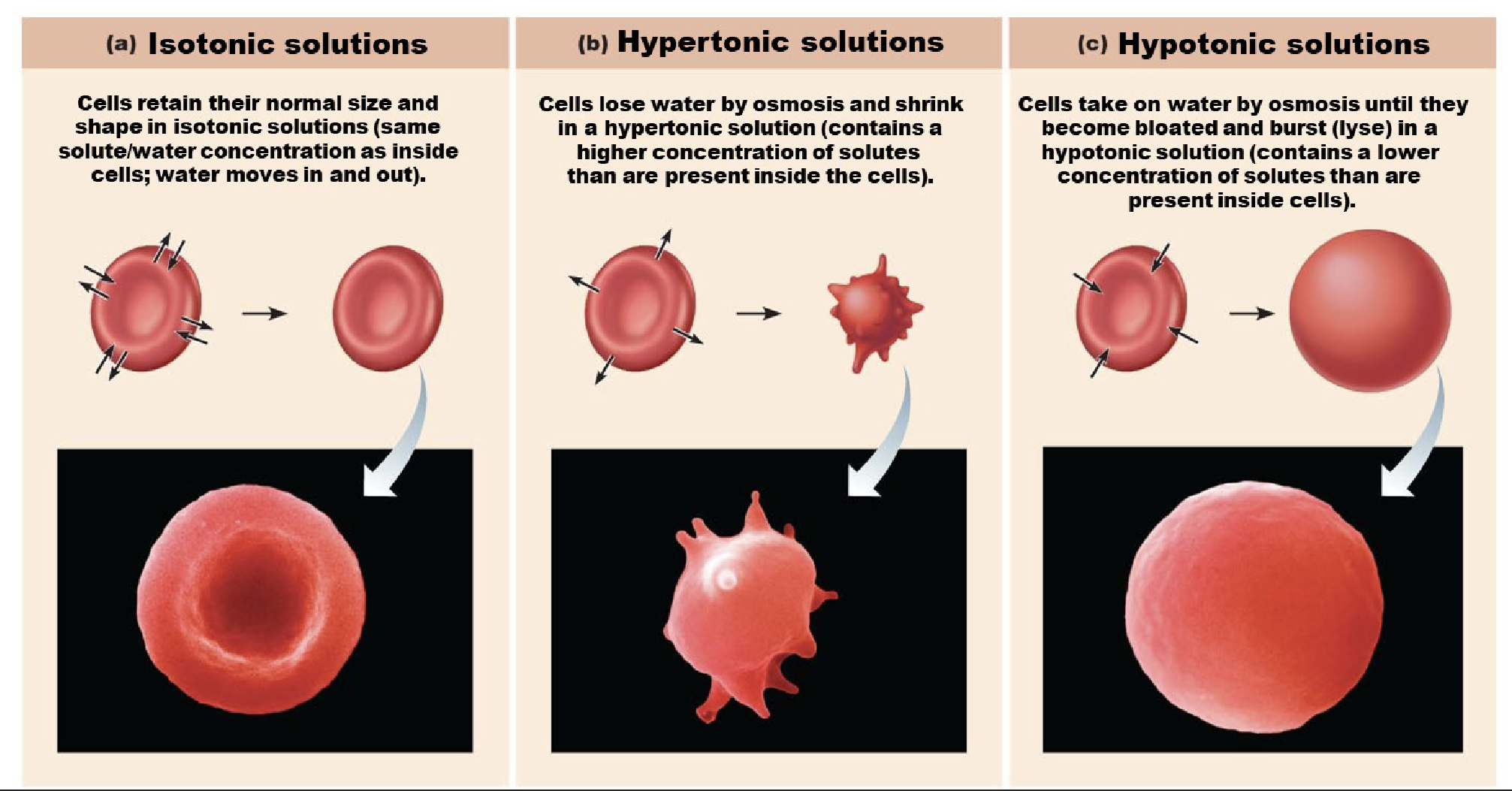 <ul><li><p>Osmosis causes cells to swell and shrink</p></li><li><p>Change in cells volume disrupts cell function, especially in Red Blood Cells and neurons</p></li><li><p>Aquaporins</p></li></ul><p></p>