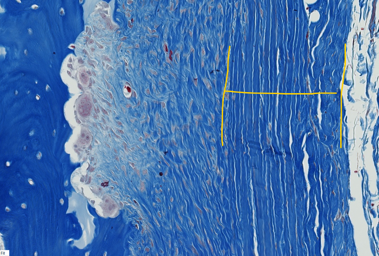 <p><span style="font-family: "Calibri Light";">In actively growing bone, the periosteum has two visible layers.<br><br>ID the yellow bracketed layer.</span></p>