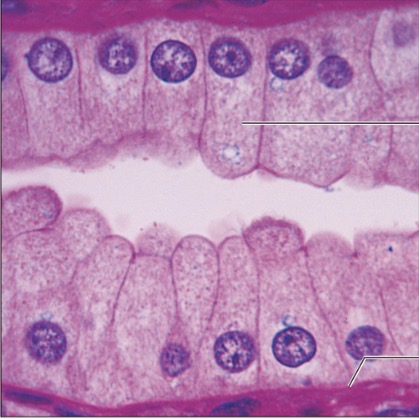 <p>what is the name of this tissue?</p>