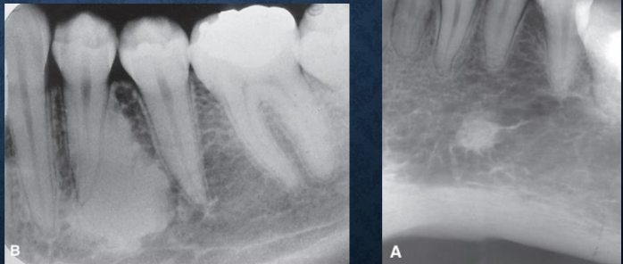 <p>how would you describe these lesions? </p>