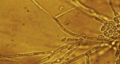 <p>pseudohyphae present</p>