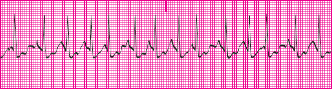 <p>Which rhythm is this?</p>