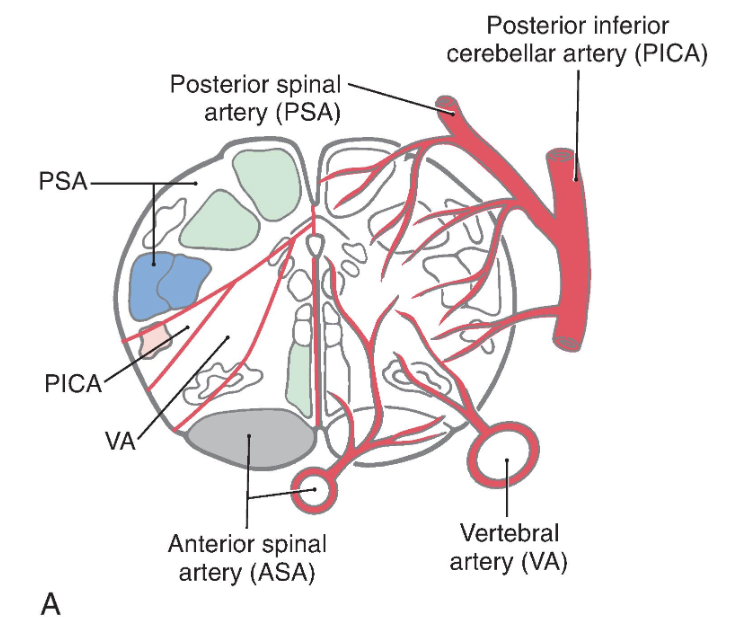 <p> Identify each of the vascular territories in the illustrations.</p><p> Identify the motor and sensory nuclei found within the territories served by each vessel.</p><p> Identify the motor and sensory tracts, or fiber bundles, found within the territories served by</p><p>each vessel. Describe the location of the cells of origin and the site(s) of termination for these</p><p>tracts/fibers. Be sure to specify laterality.</p><p> Determine what motor and sensory deficits (if any) would result from occlusion of the vessels</p><p>supplying the medulla oblongata. See text for help</p>
