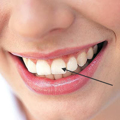<p>the teeth (f)</p>