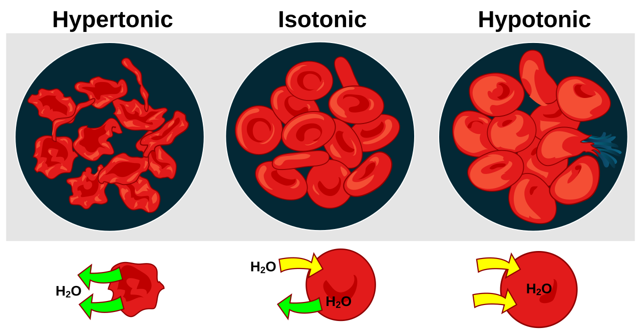 <p>Hypertonic means the solution has a higher concentration of solute compared with the solution you're comparing it to.</p>