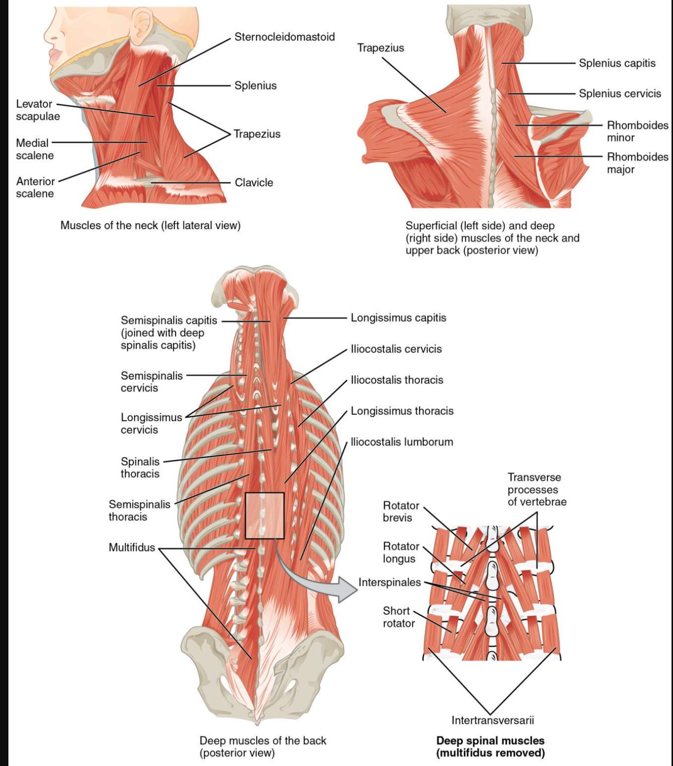 <p>latissimus dorsi</p>