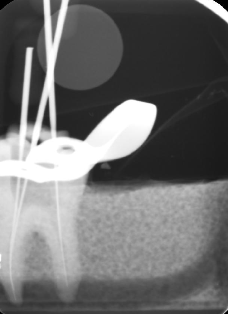 <p>the circle magnet being captured in this image indicates: </p>
