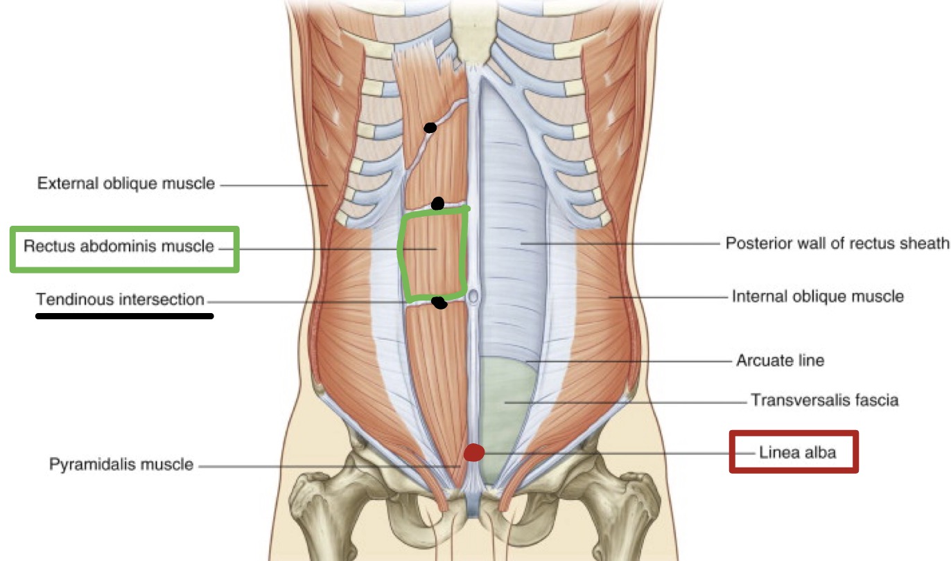 <ul><li><p>Paired muscle, separated at midline by<span style="color: rgb(252, 22, 22);"><strong> linea alba</strong></span></p></li><li><p><span style="color: rgb(8, 7, 7);">Along its course, it is intersected by 3 or 4 <strong>tendinous intersections</strong></span></p></li></ul><p></p>