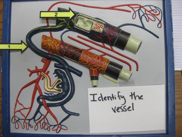 <p>Identify The Vessel 1 and 2?</p><p>Lab Image 3-3</p>
