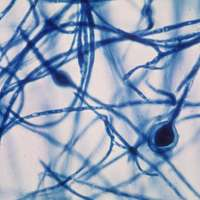 <p>slow-growing dermatophyte that causes cutaneous mycoses (tinea capitis)</p><p>can have macroconidia that are club-shaped, rare or absent microconidia</p><p></p>